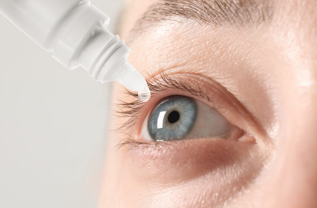 A close-up image of a person with dry eye disease carefully applying eye drops to their right eye.