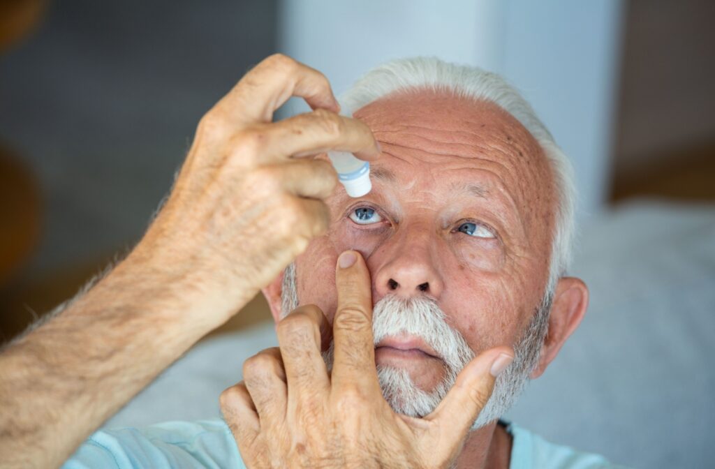 A person applies eye drops to relieve dry eye symptoms.