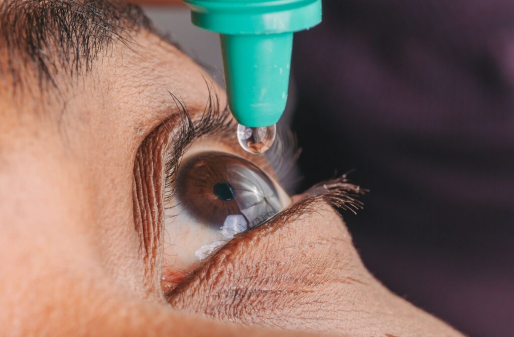 A close-up image of someone putting eye drops in their eye to combat dry eye symptoms.